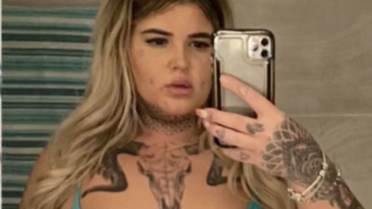 Scarlet przeszła szereg operacji plastycznych w Turcji