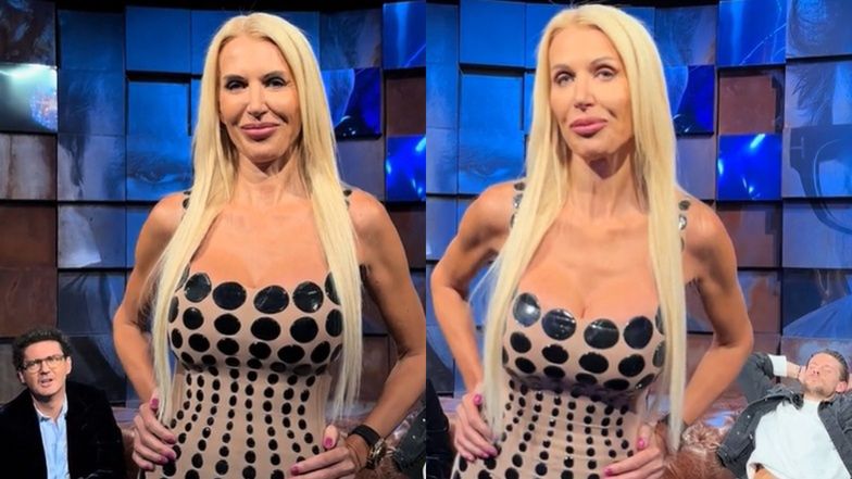 Aneta Glam u Wojewódzkiego szczerze o medycynie estetycznej