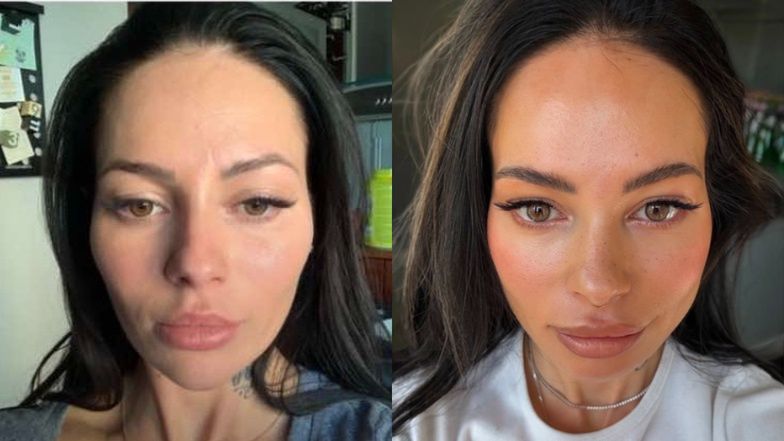 Sylwia Szostak opowiada, jak botoks zmienił jej twarz