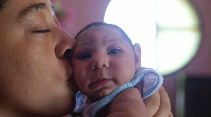 Jak wirus Zika wpływa na ciążę? Niepokojące wyniki badań