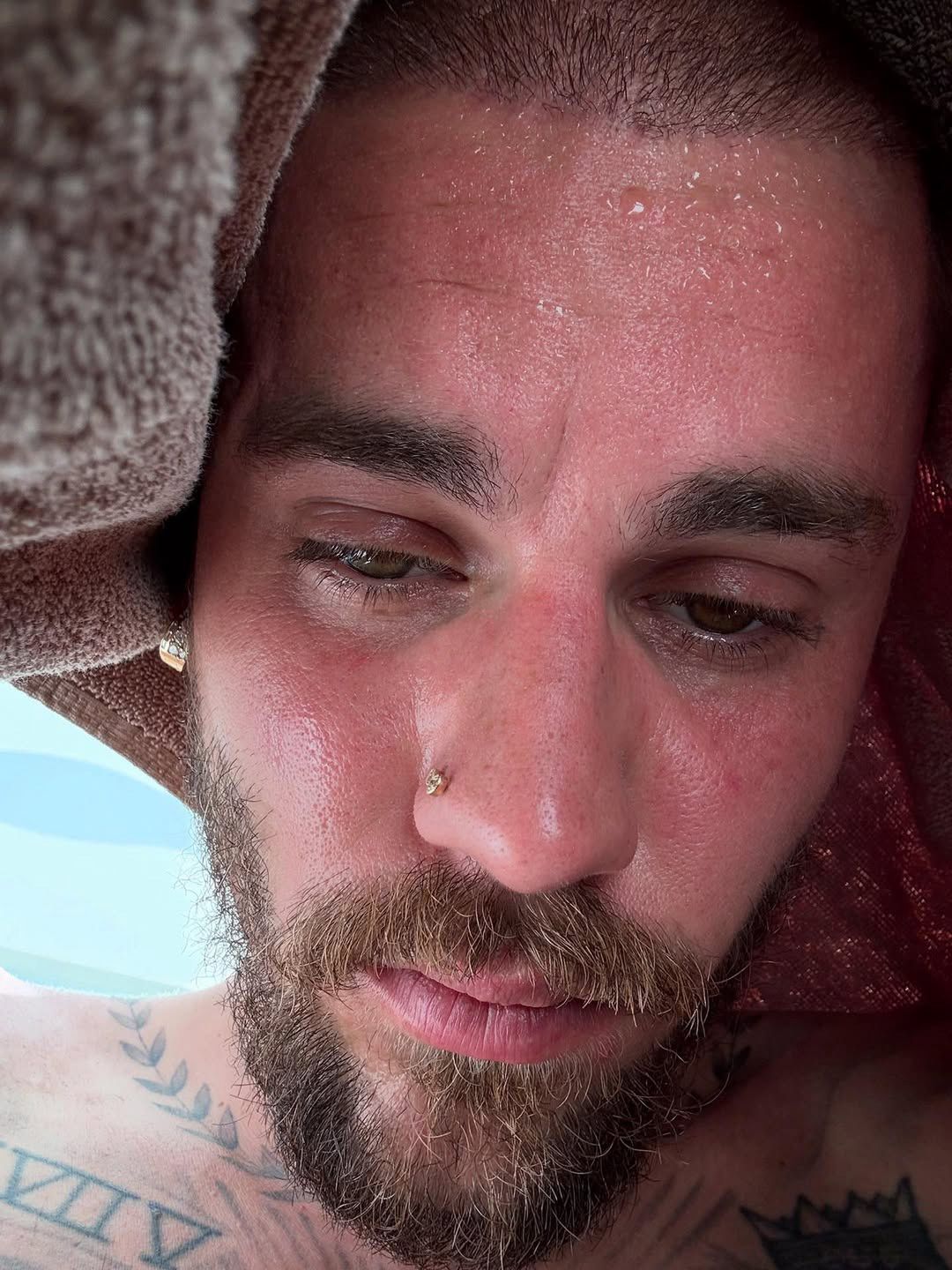 Justin Bieber na detoksie