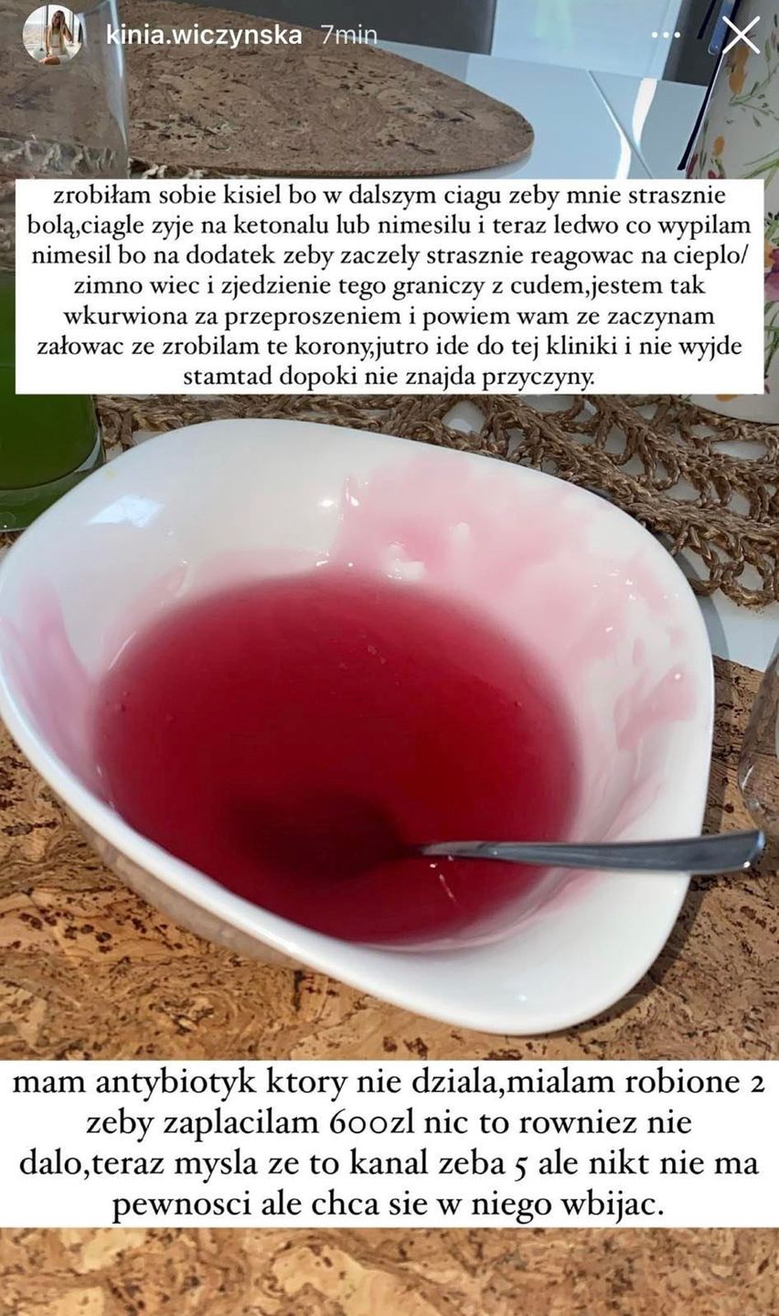 Kinia Wiczyńska narzeka na nowe zęby