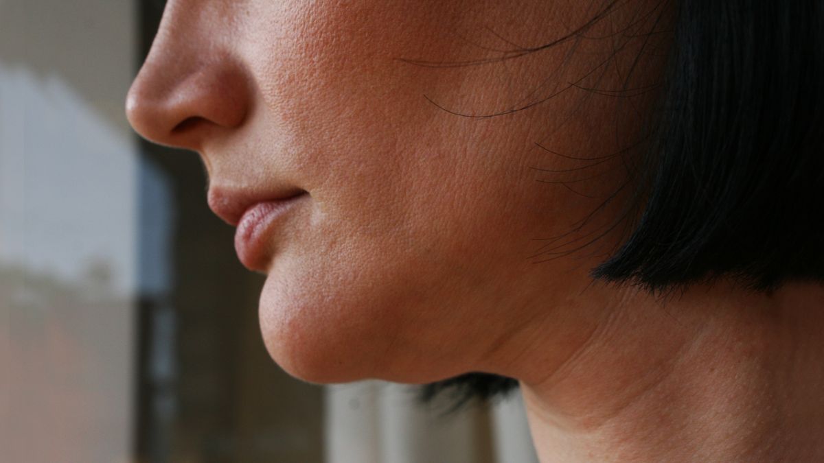 Skóra zdradzi, czy jesz za dużo cukru