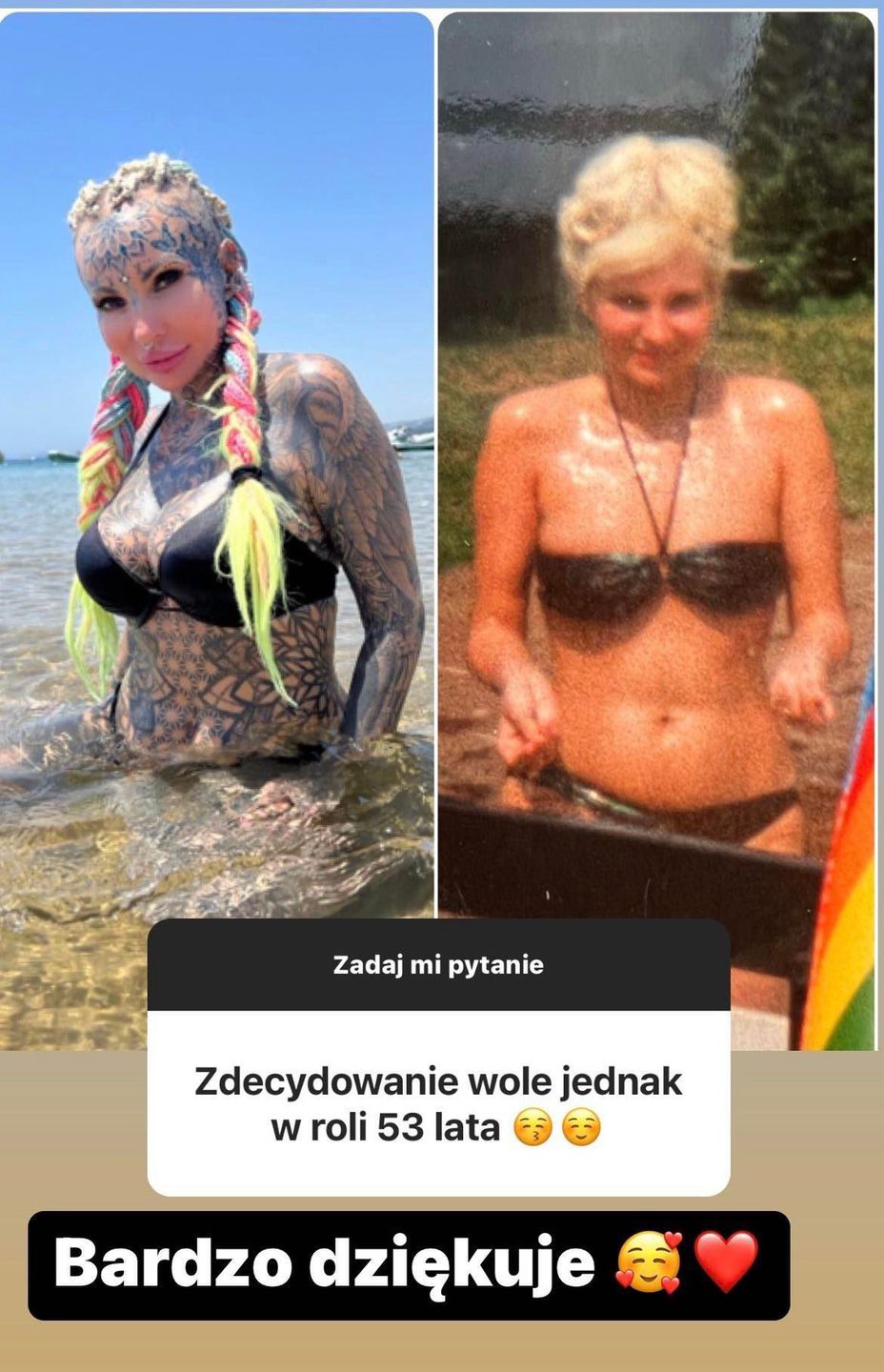Adrianna Eisenbach z "Królowych życia" o operacjach plastycznych