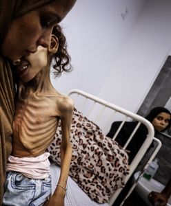 UNICEF bije na alarm. Codziennie w Gazie umiera 28 dzieci