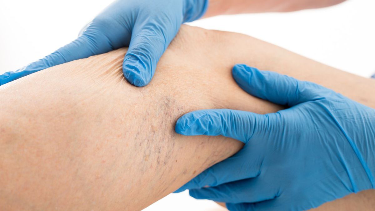 Diagnostyka zakrzepicy musi się odbywać w szybkim tempie, ponieważ istnieje duże ryzyko powikłań, w tym zgonu.