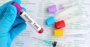 Testy alergiczne z krwi - przebieg badania, wady i zalety