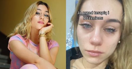 Polska tiktokerka otwiera się na temat walki z NERWICĄ LĘKOWĄ: "Obsesyjne myśli, kołatanie serca, wrażenie, że zaraz umrę..."
