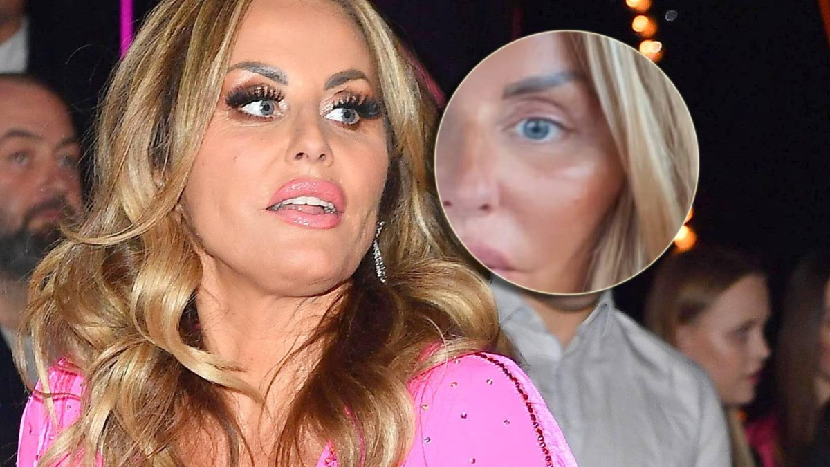 Dagmara Kaźmierka po liftingu twarzy