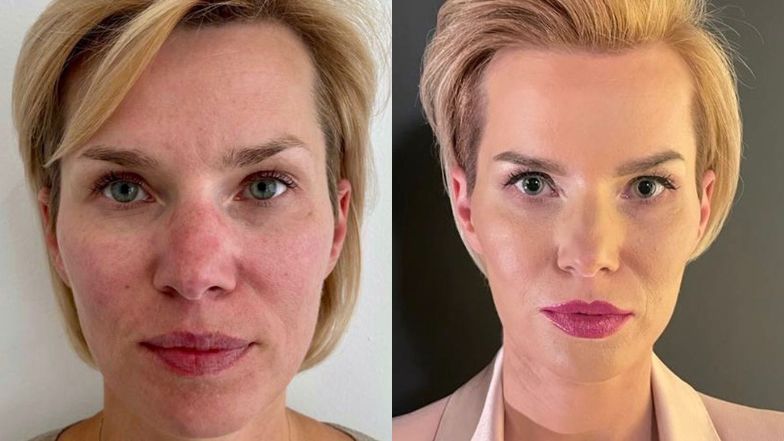 "Młodość na zamówienie". Jak zmieniły się bohaterki nowego programu o metamorfozach?