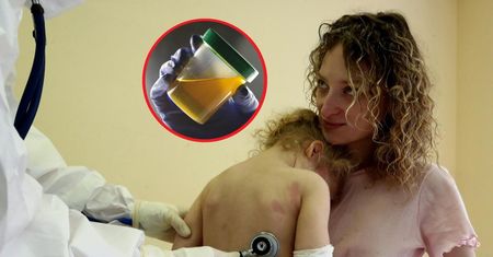 "Leczyła" moczem anginę. Lekarz nie ukrywa, co sądzi na ten temat