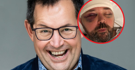 Guzy w jego mózgu rosły przez pięć lat. Jedynym objawem był ból głowy