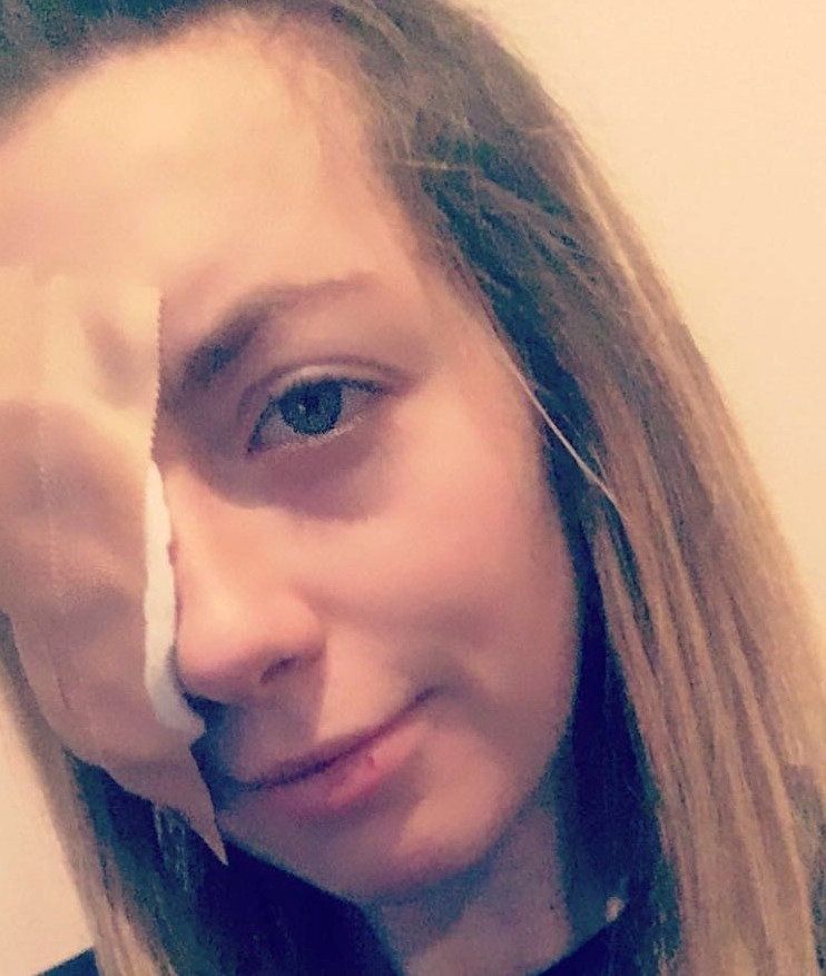 Charlotte straciła wzrok w prawym oku.