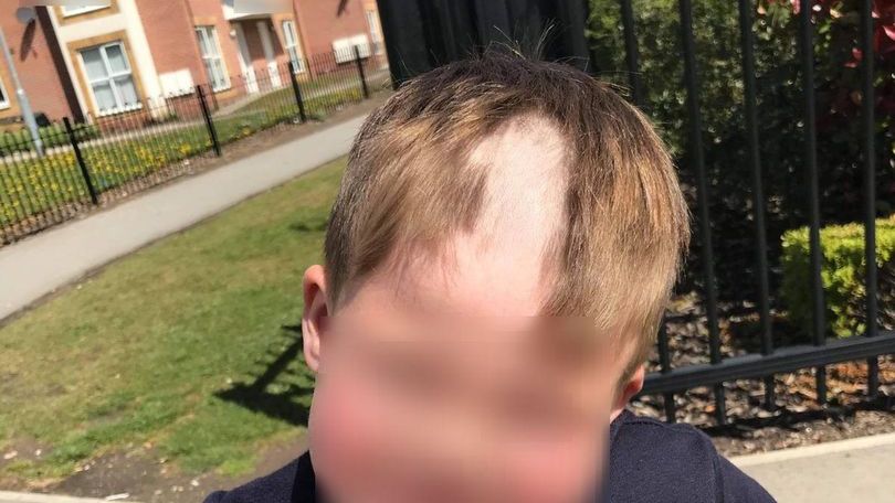 Chłopiec obciął sobie włosy
