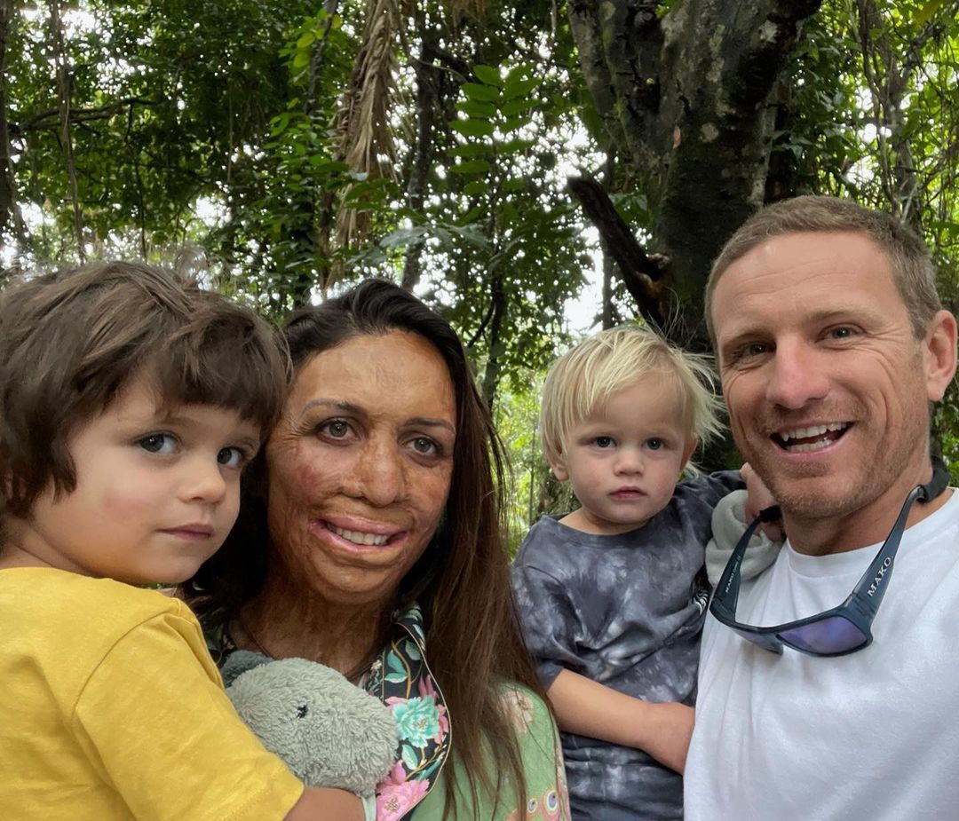 Turia Pitt