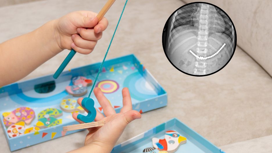 Połknięcie magnesu podczas zabawy może się skończyć poważnymi problemami zdrowotnymi.