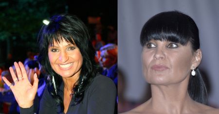 Pavlović też "poprawiła" twarz?