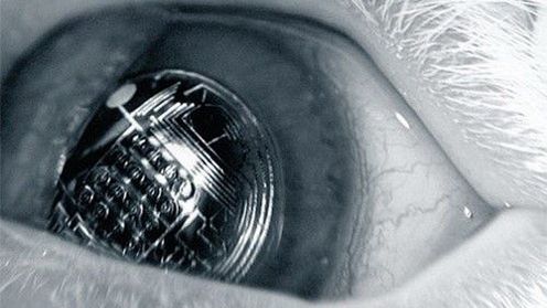 Oczy - zwierciadło duszy i wyznacznik zdrowia? 1