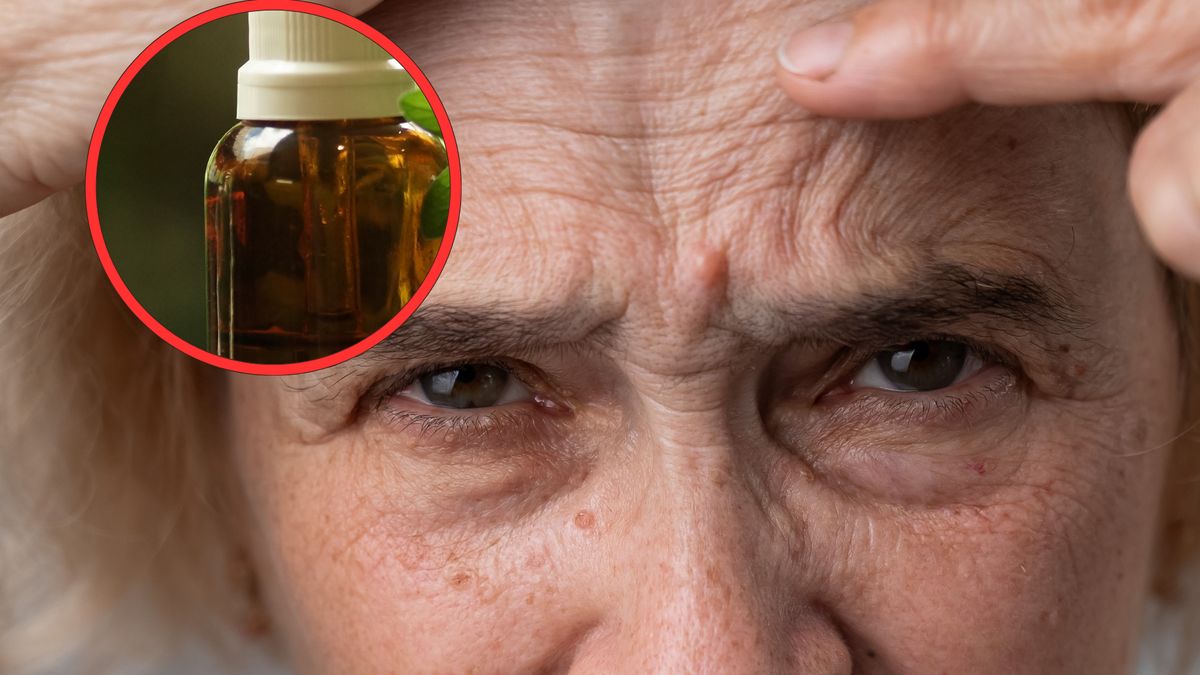 Olej z opuncji figowej działa zbawiennie na skórę dojrzałą