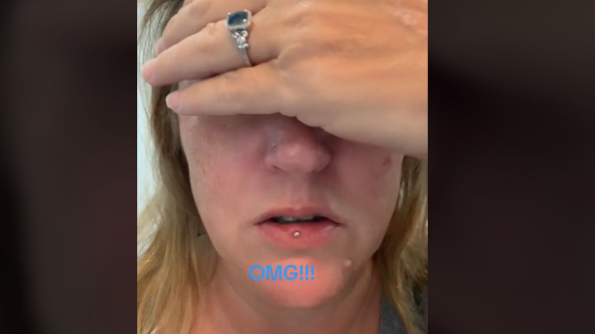 Paskudne skutki nieudanego zabiegu kosmetycznego 