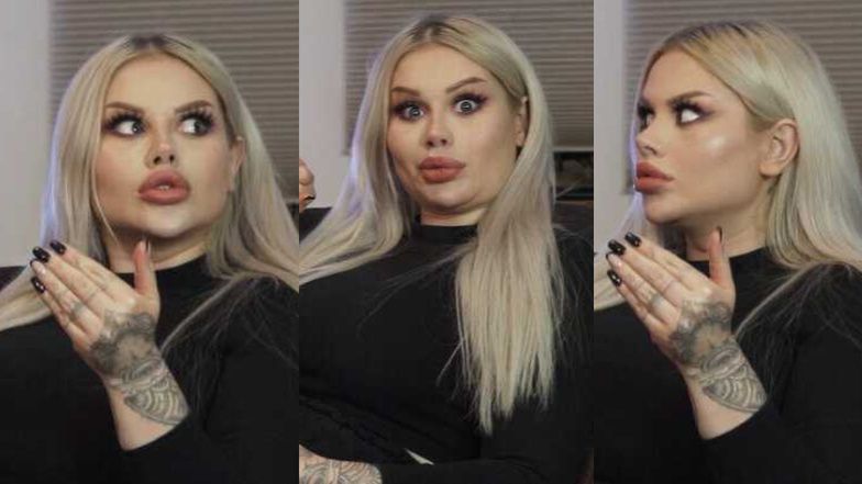 Ewel0na zdradza kulisy serii operacji plastycznych, której się poddała