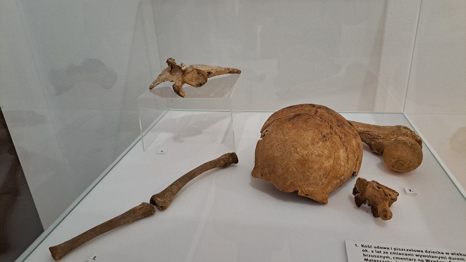 Co cię nie zabije, to cię wzmocni - wystawa w Muzeum Górnośląskim w Bytomiu