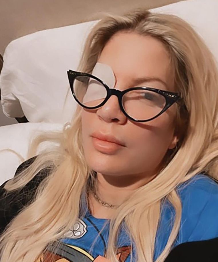 Tori Spelling nabawiła się infekcji oka