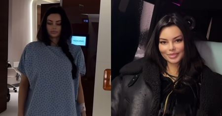 Justyna Gradek poddała się liposukcji. Mówi o szczegółach operacji: "Była wymagająca i trwała prawie 6 godzin"