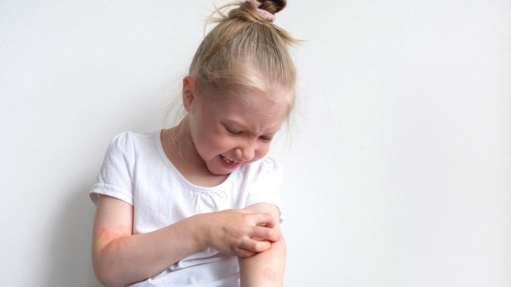 Uczulenie na wełnę może objawiać się m.in. swędzeniem skóry