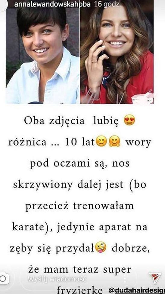 "Lewa" wspomina swoją metamorfozę
