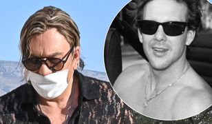 Mickey Rourke ma zmasakrowaną twarz. Wszystko przez operacje