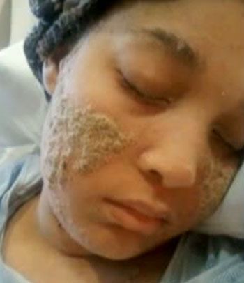 youtube.com Ciało Shanyna Isom produkuje paznokcie zamiast włosów na ciele 