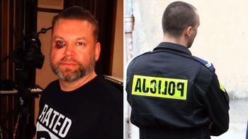 Producent muzyczny został pobity w barze. "Sześć szwów, trzy złamane zęby"