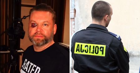 Producent muzyczny został pobity w barze. "Sześć szwów, trzy złamane zęby"