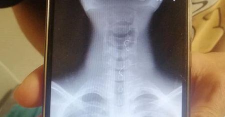 Nastolatek umierał przed sklepem. Heroiczny czyn strażaka uratował mu życie