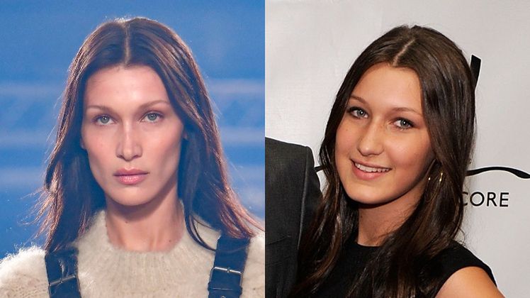 Bella Hadid przyznała się do operacji nosa