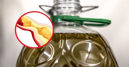 Chronią żyły przed zakrzepicą. Te produkty zmniejszają odkładanie złogów