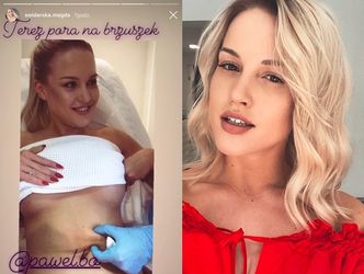 Magda z "Projekt Lady" powiększyła piersi? Pokazała blizny na Instagramie