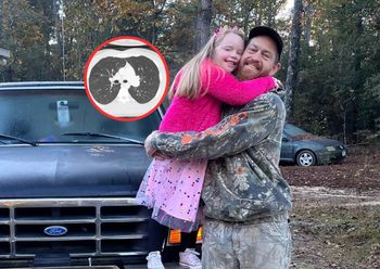 Rak zajął jelita, płuca. Pierwszy objaw był widoczny, ale źle go odczytano