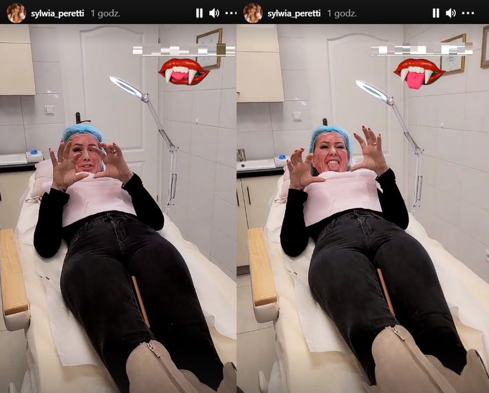 Sylwia Peretti robi sobie wampirzy lifting