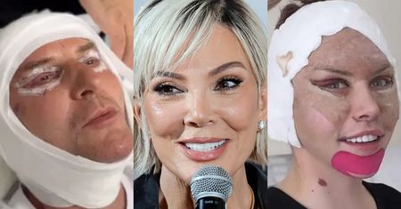 Te gwiazdy zafundowały sobie LIFTING. Tak ewoluowały twarze Krzysztofa Gojdzia, Julii von Stein, Kris Jenner i innych... (ZDJĘCIA)