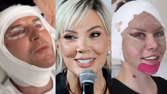 Te gwiazdy zafundowały sobie LIFTING. Tak ewoluowały twarze Krzysztofa Gojdzia, Julii von Stein, Kris Jenner i innych... (ZDJĘCIA)