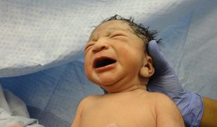 Kobiety rodzą bez znieczulenia. Fatalne dane ze szpitali
