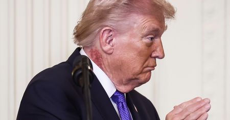 Co widać na szyi Trumpa? Jego lekarz zabiera głos
