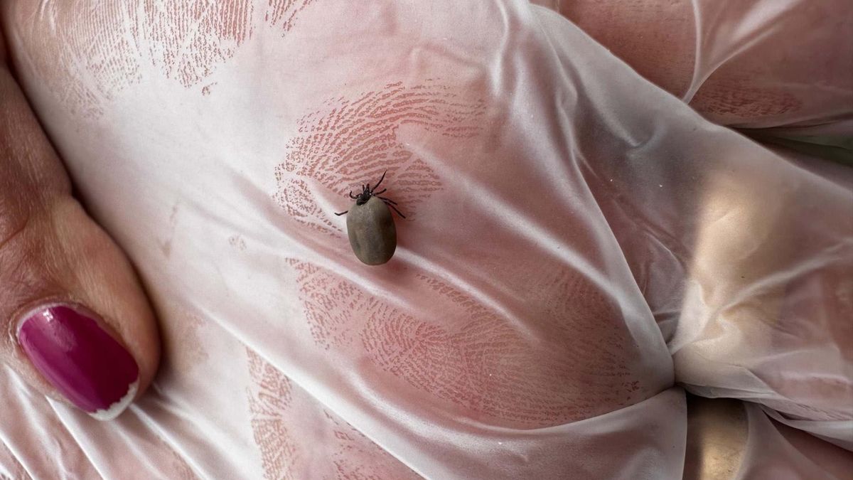 Nie masz pod ręką pęsety? Tak szybko i bezpiecznie wyjmiesz kleszcza