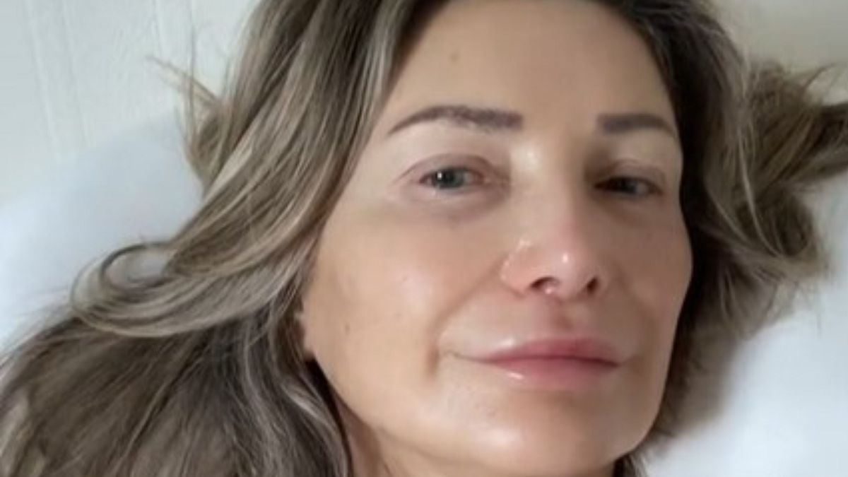 Nie uwierzysz, ile ma lat. Tak wygląda po operacji w Turcji!