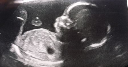 W tym kraju aborcja jest legalna. Lekarze masowo odmawiają