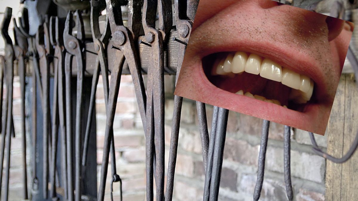 Szokujący raport na temat opieki dentystycznej w Wielkiej Brytanii