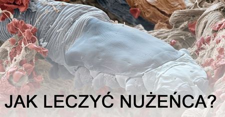 Jak leczyć nużeńca? Poznaj sprawdzone metody