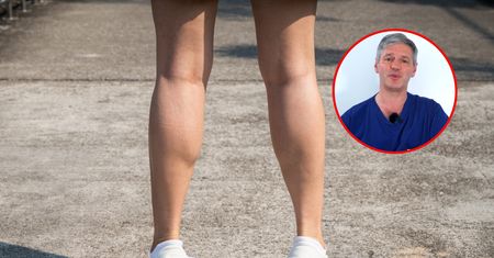 Profesor poleca prosty test. Zdradza, czy zakrzep blokuje żyły